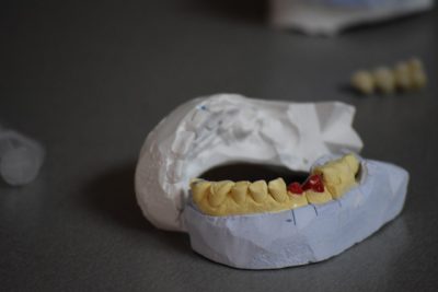 kiefer-modell-zahnarztpraxis